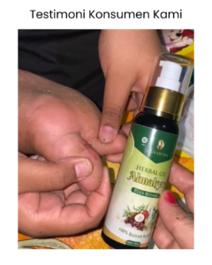 testimoni asam urat pada kaki setelah menggunakan Herbal Oil Almahyra