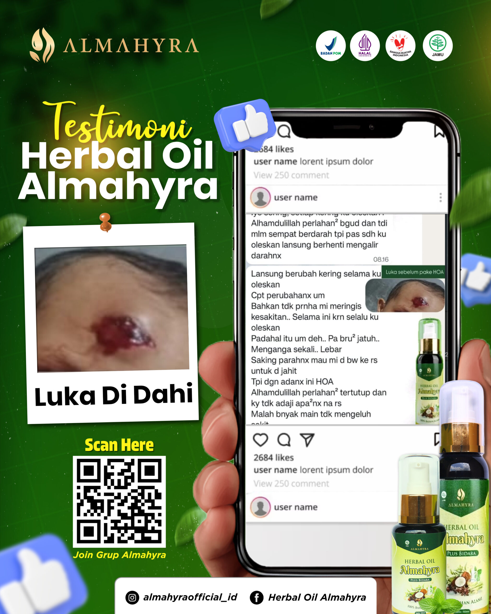 16 Maret 2026 New Desain Testimoni luka di dahi