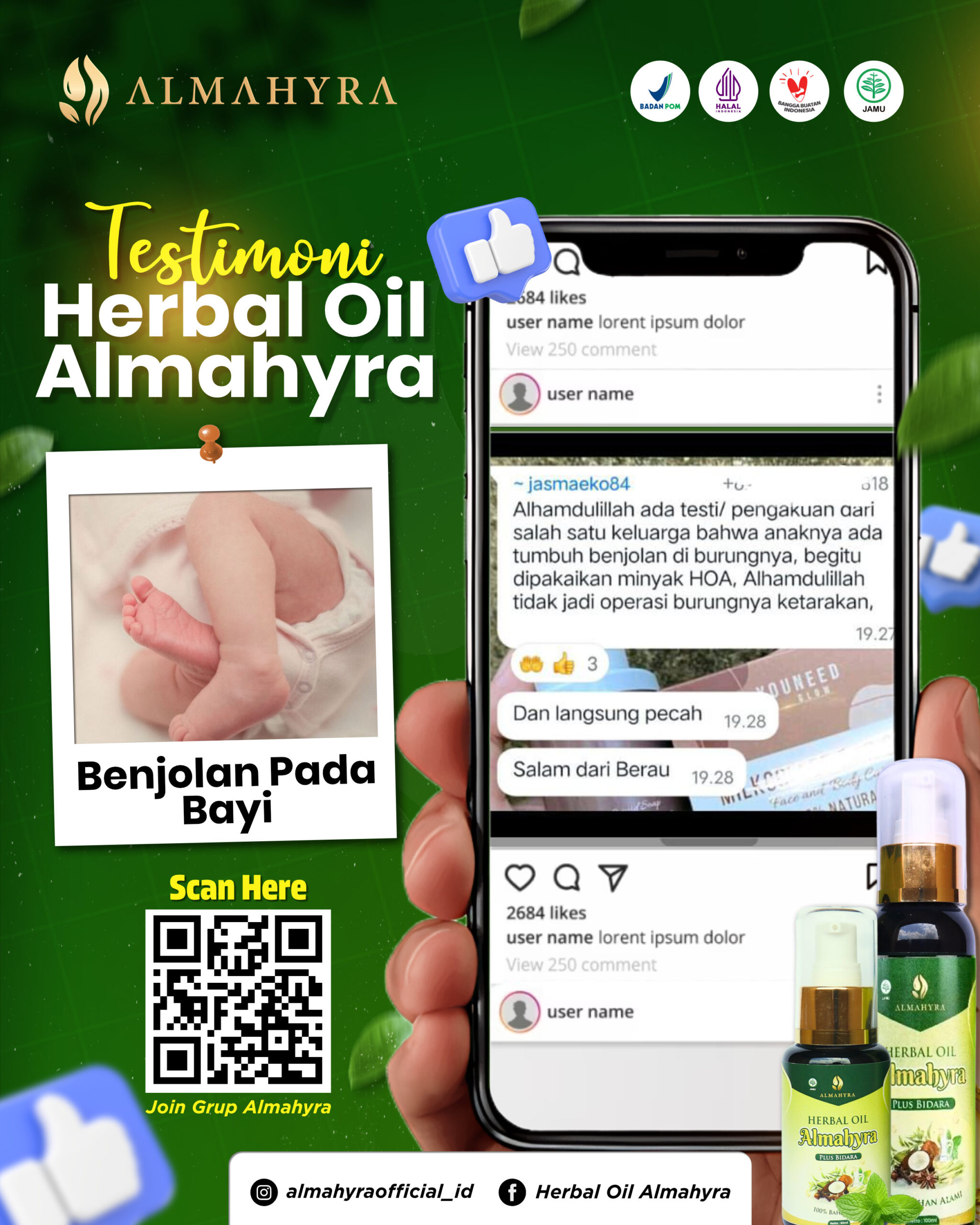 31 Maret 2026 New Desain Testimoni benjolan pada bayi